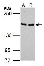 MSH6 Antibody in Western Blot (WB)