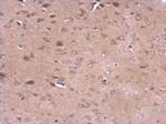 CD10 Antibody in Immunohistochemistry (Paraffin) (IHC (P))