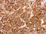 CD10 Antibody in Immunohistochemistry (Paraffin) (IHC (P))