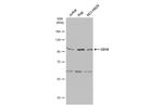 CD10 Antibody in Western Blot (WB)