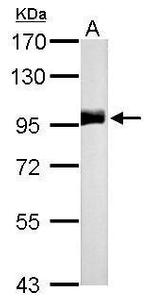 CD10 Antibody in Western Blot (WB)