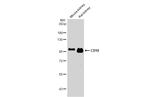 CD10 Antibody in Western Blot (WB)