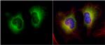 TGM2 Antibody in Immunocytochemistry (ICC/IF)