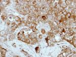 TGM2 Antibody in Immunohistochemistry (Paraffin) (IHC (P))