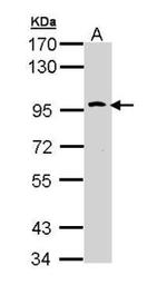 TLR10 Antibody in Western Blot (WB)