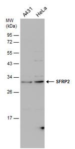 SFRP2 Antibody in Western Blot (WB)