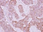 LOK Antibody in Immunohistochemistry (Paraffin) (IHC (P))