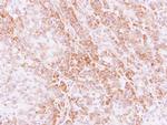 STK32C Antibody in Immunohistochemistry (Paraffin) (IHC (P))