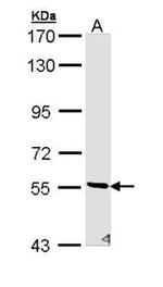 STK32C Antibody in Western Blot (WB)