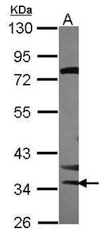 STK16 Antibody in Western Blot (WB)