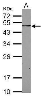 SAB Antibody in Western Blot (WB)