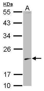 SKP1 Antibody in Western Blot (WB)