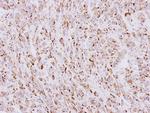 beta COP Antibody in Immunohistochemistry (Paraffin) (IHC (P))