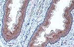 TUBA1A Antibody in Immunohistochemistry (Paraffin) (IHC (P))