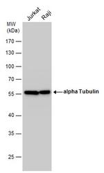 TUBA1A Antibody in Western Blot (WB)