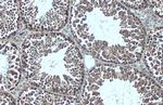 G3BP1 Antibody in Immunohistochemistry (Paraffin) (IHC (P))