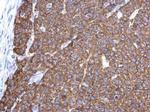 G3BP1 Antibody in Immunohistochemistry (Paraffin) (IHC (P))