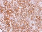 Cytokeratin 4 Antibody in Immunohistochemistry (Paraffin) (IHC (P))