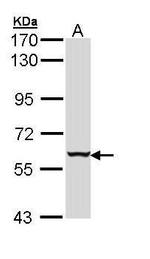 Cytokeratin 4 Antibody in Western Blot (WB)