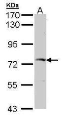 GGA2 Antibody in Western Blot (WB)