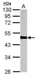 HERPUD1 Antibody in Western Blot (WB)