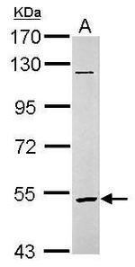 GABRR2 Antibody in Western Blot (WB)