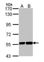 KPNA1 Antibody in Western Blot (WB)