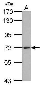 L3MBTL4 Antibody in Western Blot (WB)