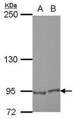 E2F8 Antibody in Western Blot (WB)