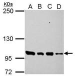 PDE3A Antibody in Western Blot (WB)