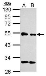 eIF3e Antibody in Western Blot (WB)