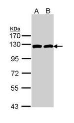 ATP Citrate Lyase Antibody in Western Blot (WB)