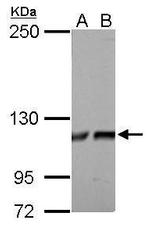 ATP Citrate Lyase Antibody in Western Blot (WB)