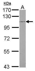 beta Adducin Antibody in Western Blot (WB)