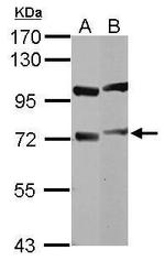 DYNC1I1 Antibody in Western Blot (WB)