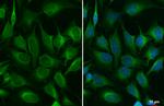 ACSL3 Antibody in Immunocytochemistry (ICC/IF)