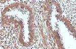 ACSL3 Antibody in Immunohistochemistry (Paraffin) (IHC (P))