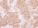 beta-2 Adaptin Antibody in Immunohistochemistry (Paraffin) (IHC (P))