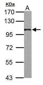 beta-2 Adaptin Antibody in Western Blot (WB)