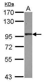 beta-2 Adaptin Antibody in Western Blot (WB)