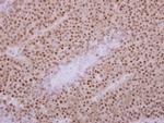 KIF3C Antibody in Immunohistochemistry (Paraffin) (IHC (P))