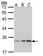 p23 Antibody in Western Blot (WB)