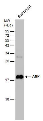 ANP Antibody in Western Blot (WB)