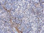 COL1A1 Antibody in Immunohistochemistry (Paraffin) (IHC (P))