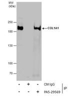 COL1A1 Antibody in Immunoprecipitation (IP)