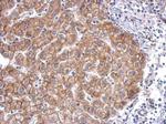 N-cadherin Antibody in Immunohistochemistry (Paraffin) (IHC (P))