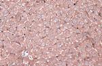 N-cadherin Antibody in Immunohistochemistry (Paraffin) (IHC (P))