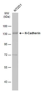 N-cadherin Antibody in Western Blot (WB)