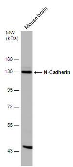 N-cadherin Antibody in Western Blot (WB)