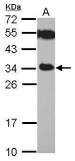 TICAM2 Antibody in Western Blot (WB)